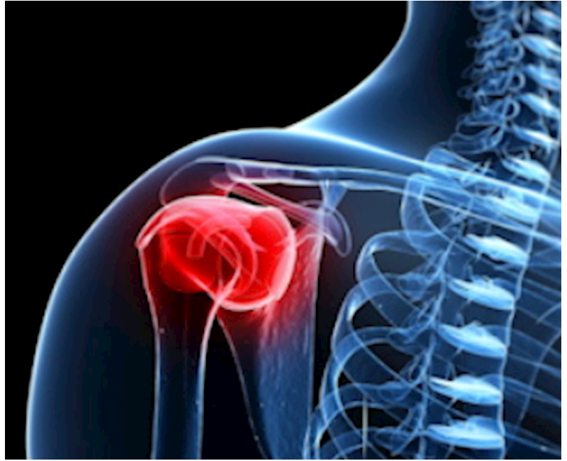 Elastography shows promise for rotator cuff tears
